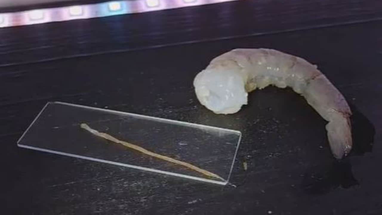 Así se ve una tripa, vena o intestino de camarón en microscopio, video