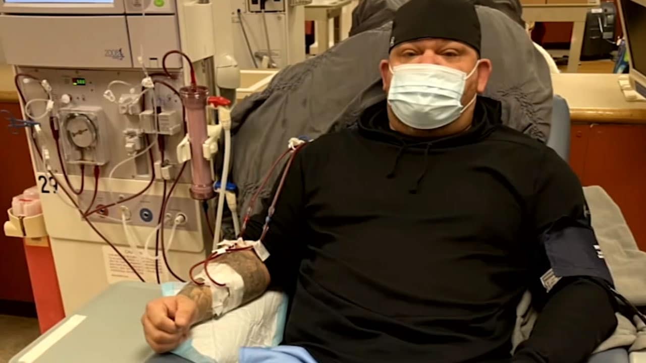 Hospital niega trasplante riñón hombre rechaza vacuna covid