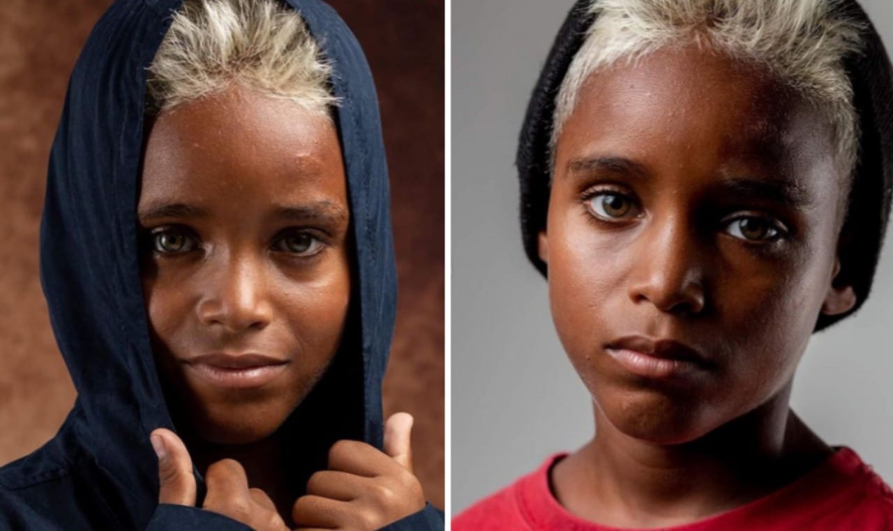 Niño que vivía en favela de Brasil se hace modelo