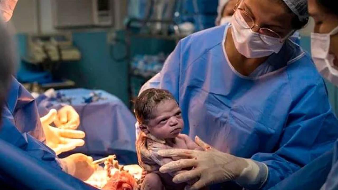 Bebé que nació enojada se reencuentra con el fotógrafo