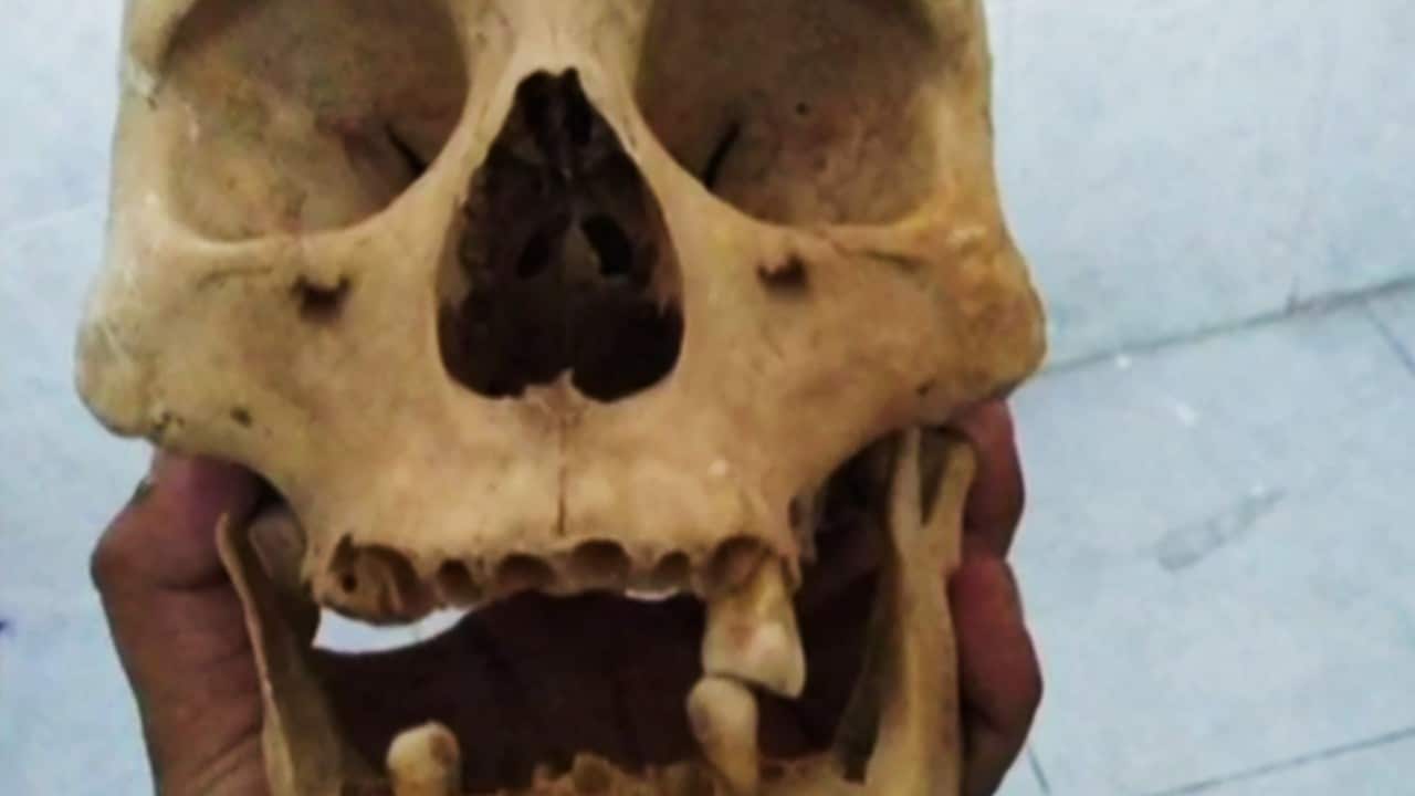 Compran en panteones restos humanos que exigen maestros a alumnos de medicina y odontología