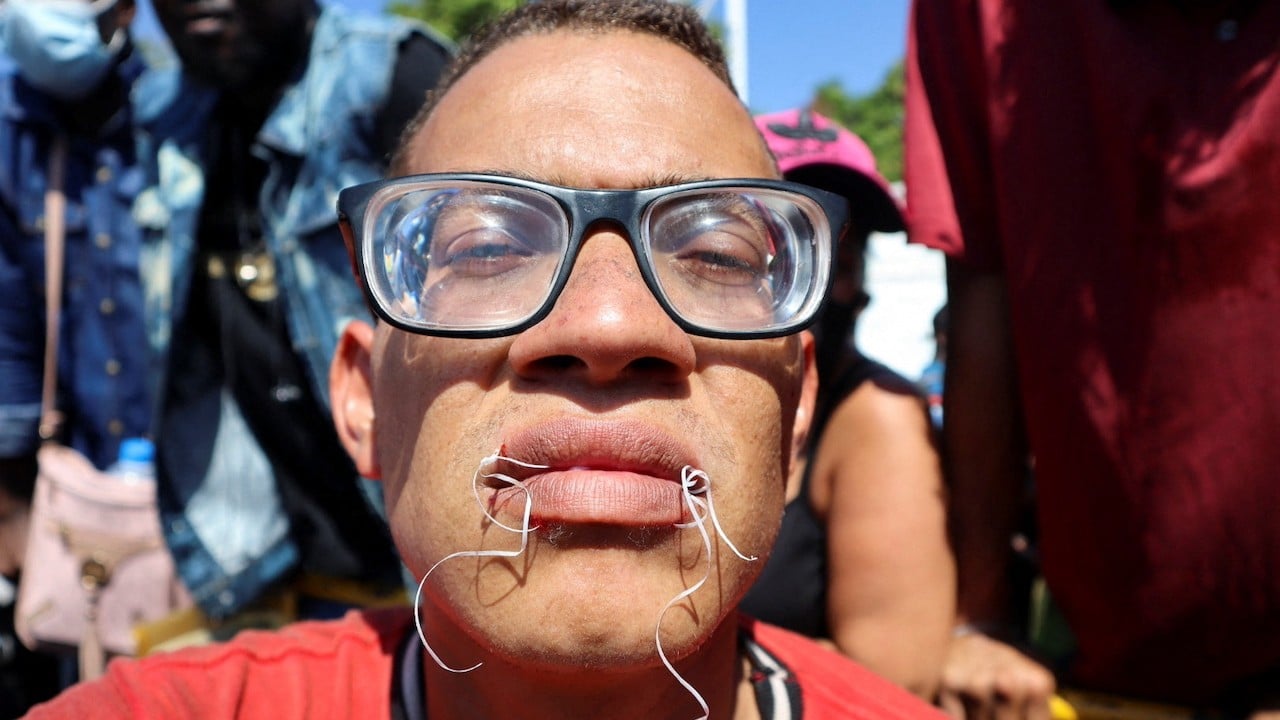 Un migrante inicia una huelga de hambre con la boca cosida durante una protesta para exigir el libre tránsito en México (Reuters)