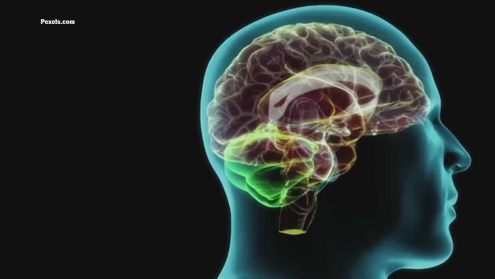 covid 19 provoca cambios en estructura cerebral revela estudio
