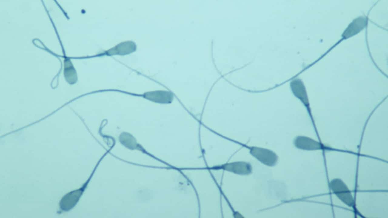 Fotografía que muestra desde un microscopio la cabeza y el flagelo de un espermatozoide