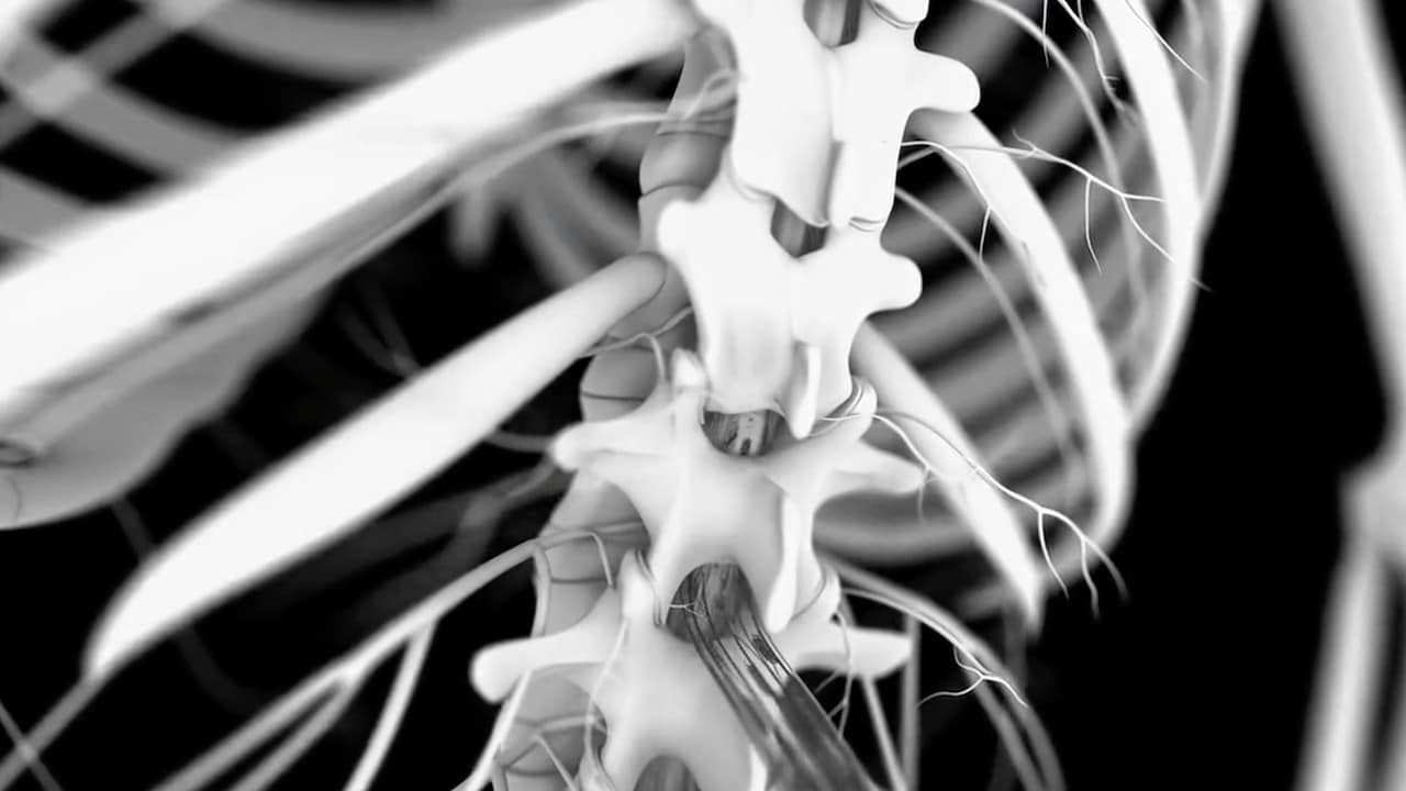 Implante de un conjunto de electrodos personalizado para activar directamente neuronas motoras espinales (Twitter: @delsysinc)