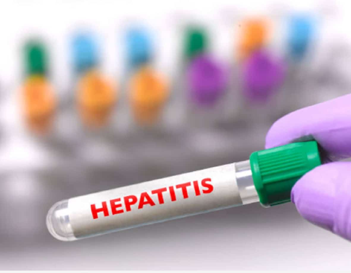 Aumentan a 429 los casos de hepatitis aguda infantil en todo el mundo: OMS