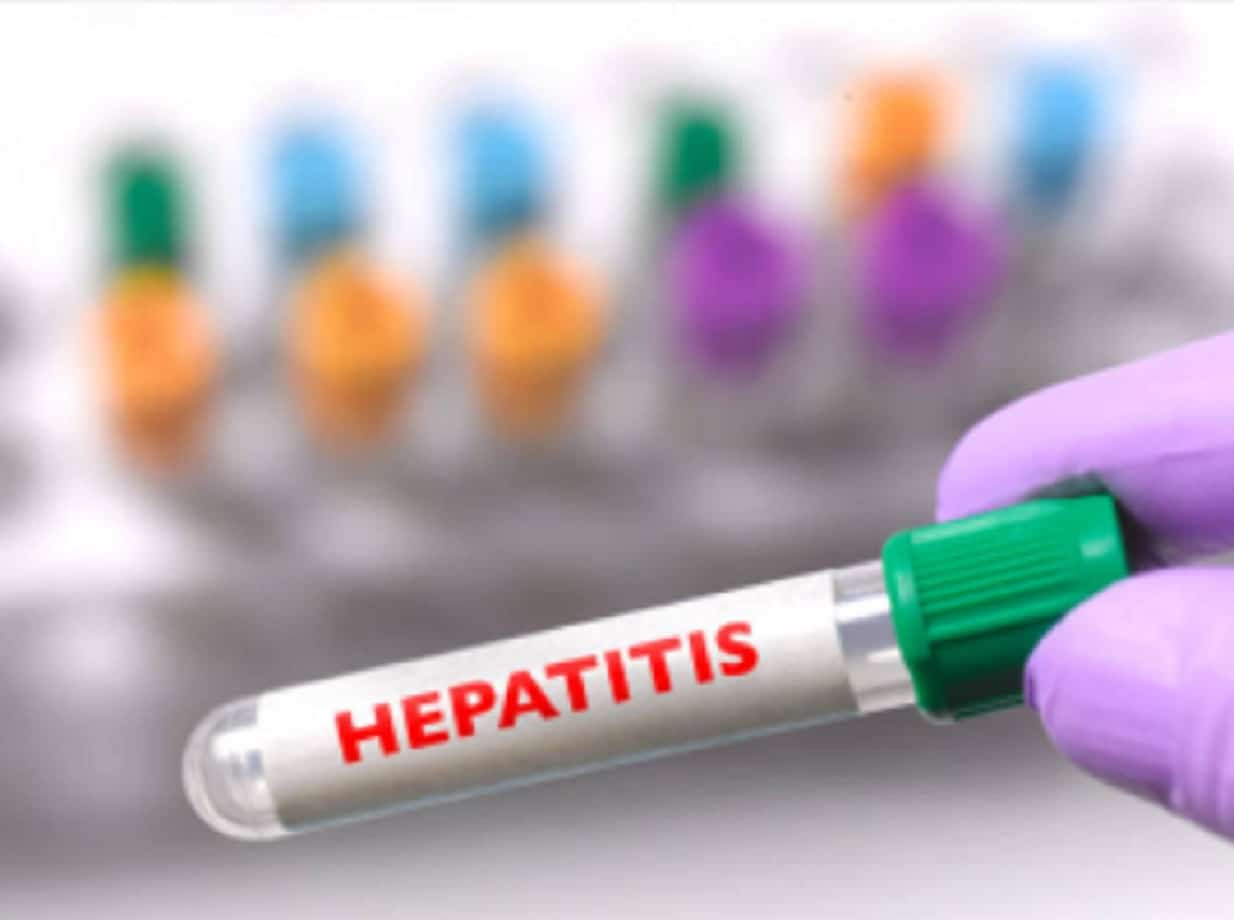 Confirman 4 muertes por hepatitis infantil en Indonesia