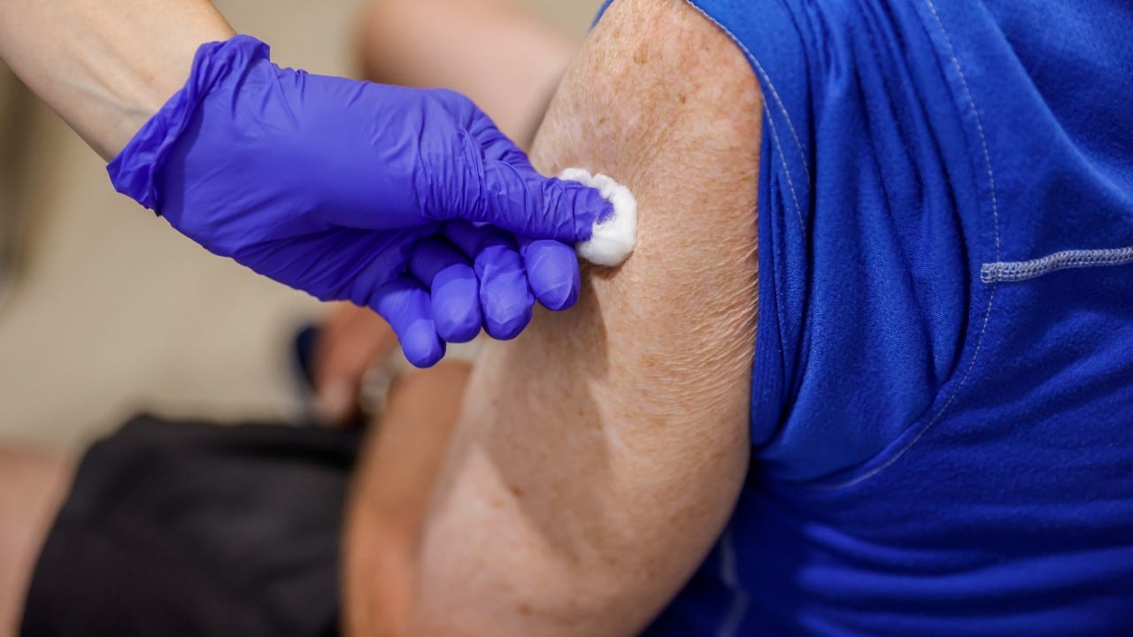 Colocan una bola de algodón en el brazo de un paciente después de ser vacunado (Getty Images)