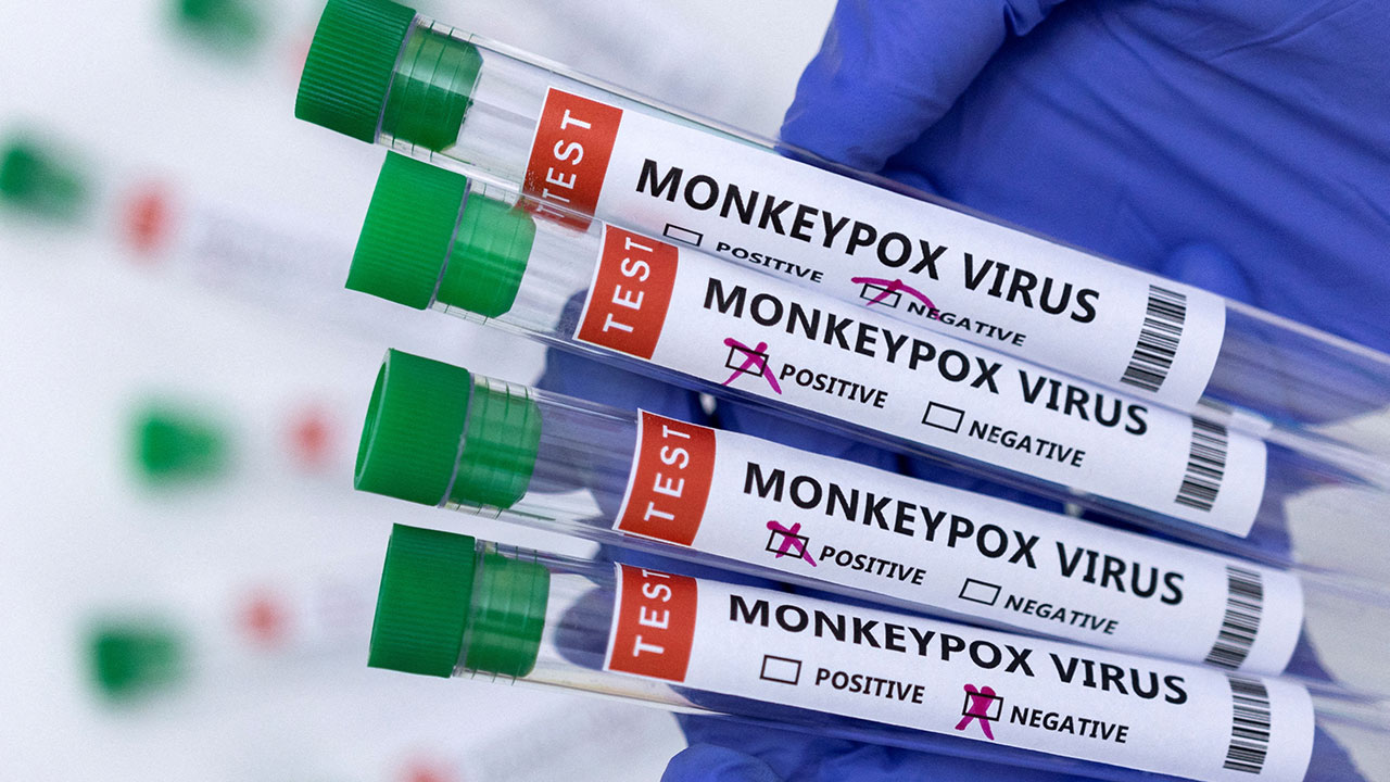 UNAM recomendaciones evitar contagios viruela del mono