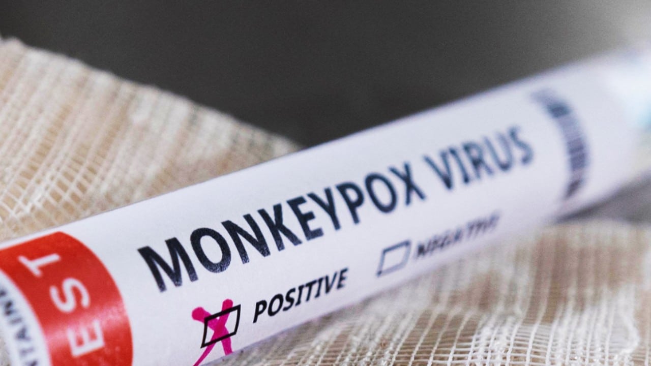 EEUU confirman hasta ahora 12 casos de viruela del mono
