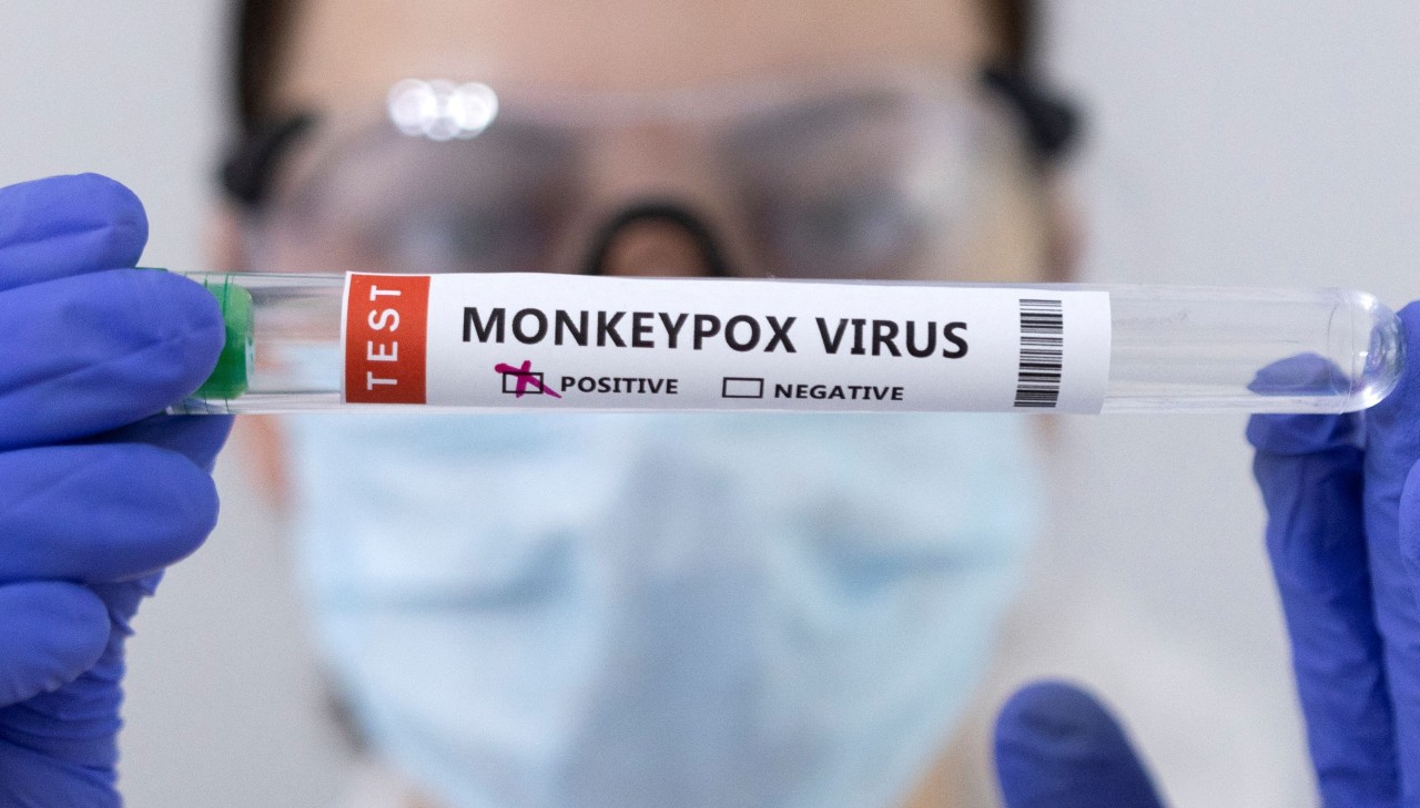 EEUU detecta nuevos cuatro casos sospechosos de viruela del mono