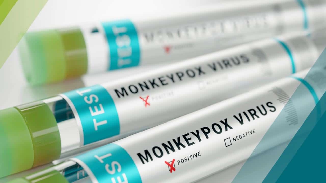 Aumentan casos de viruela del mono en el mundo.