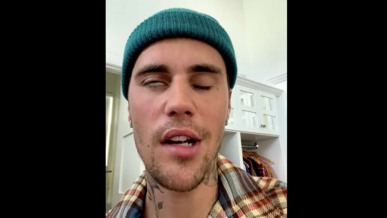 Justin Bieber muestra signos de recuperación tras parálisis facial: médico.