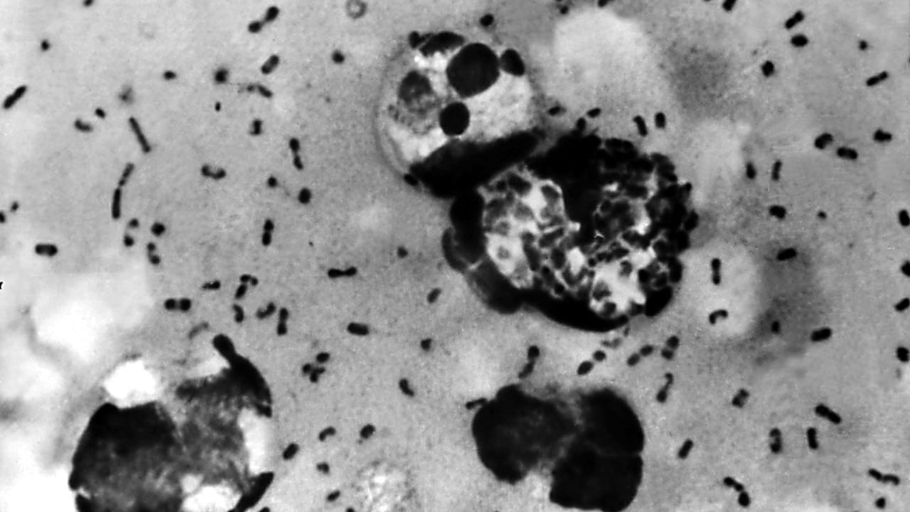 La peste bubónica mató a miles de personas en el siglo XIV