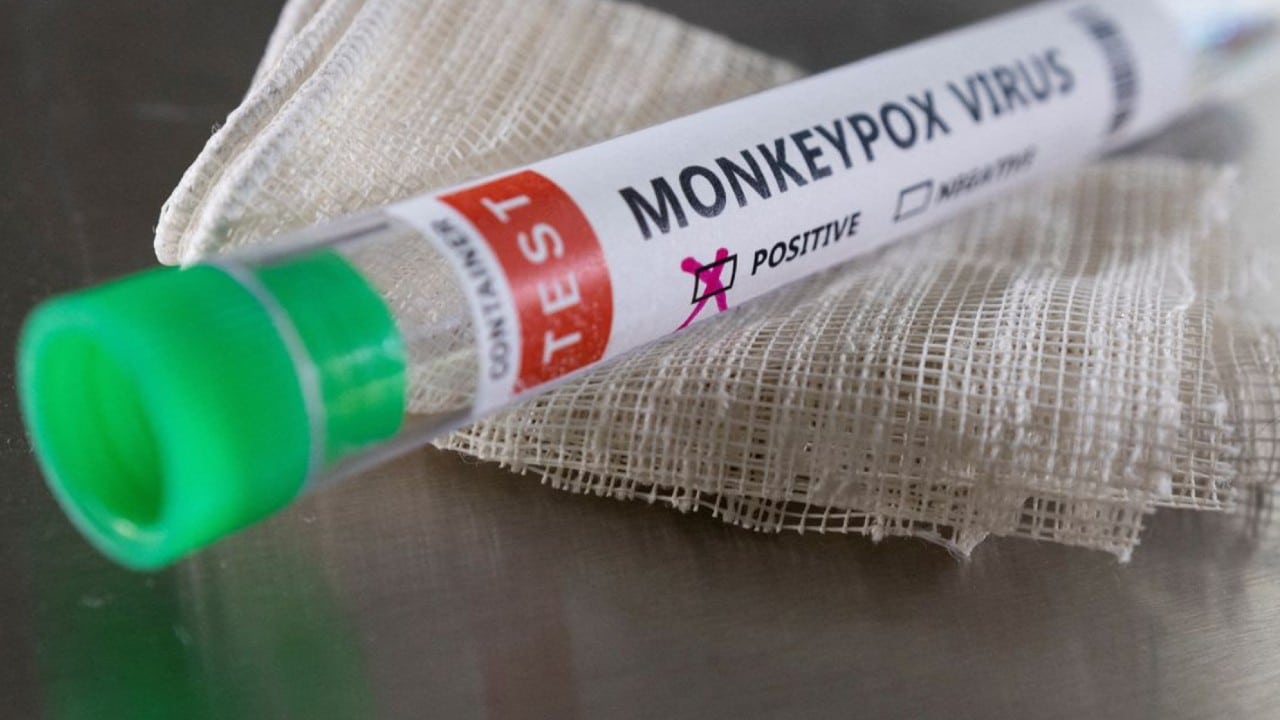 Turquía confirma su primer caso de viruela del mono