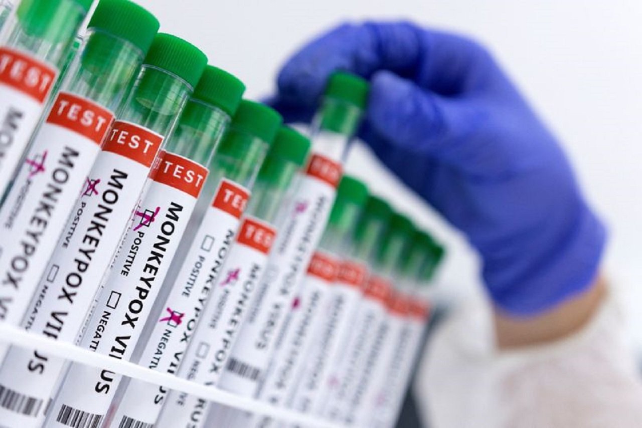 EUA cuenta con 56 mil vacunas contra viruela del mono