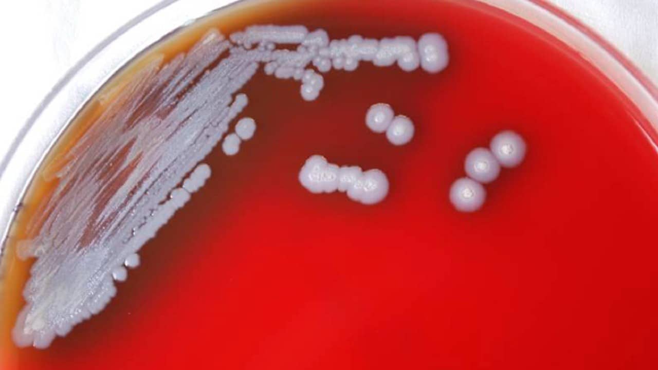 Detectan en EUA bacteria que causa melioidosis