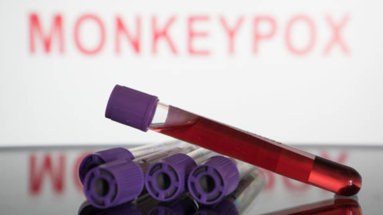 Nueva York declara el estado de emergencia por aumento de casos de viruela del mono