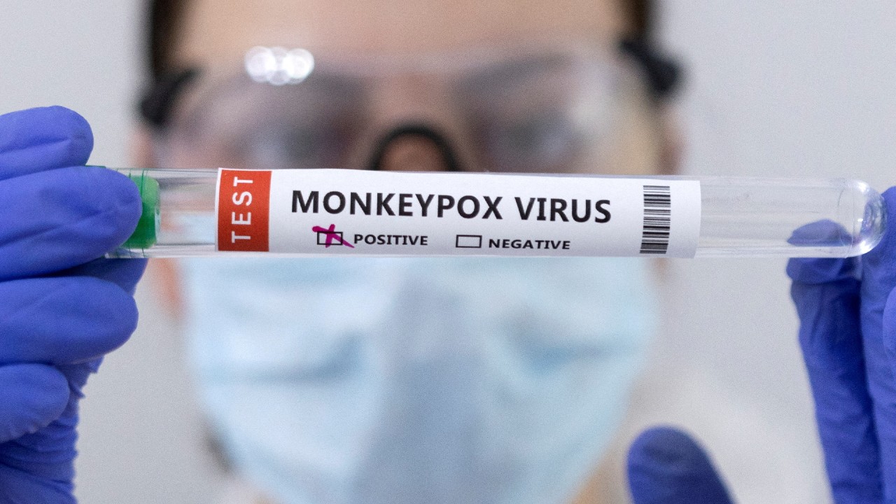 Detectan a primera mujer infectada con la viruela del mono en Bélgica