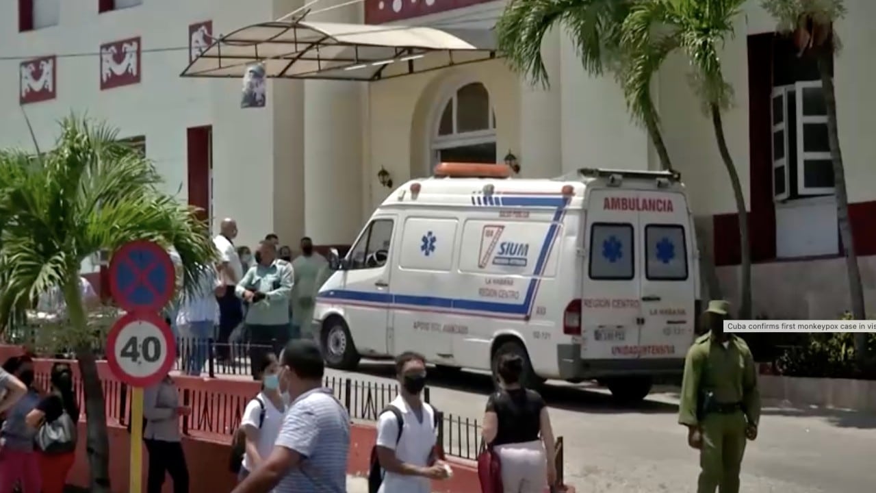 Fallece el primer caso de viruela del mono detectado en Cuba