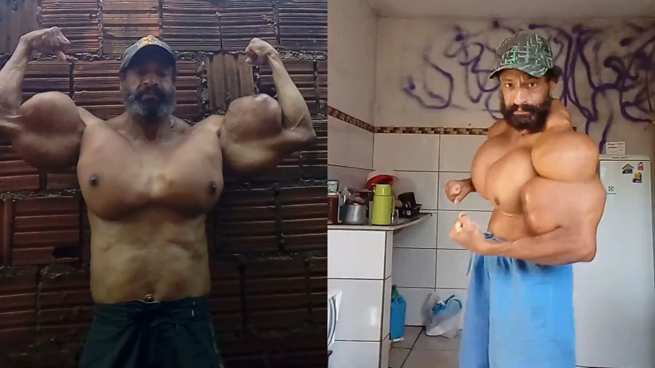 Muere Hulk brasileño, hombre que se inyectaba aceite para sus músculos