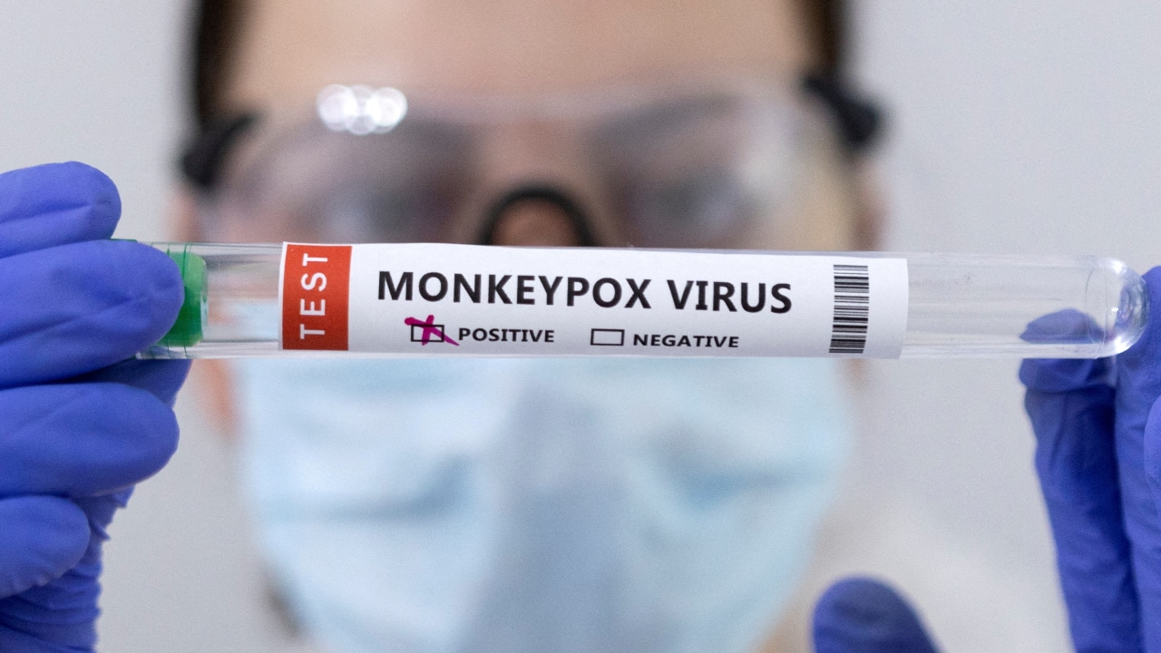 Personal sanitario sostiene un tubo etiquetado con una muestra positiva de viruela del mono