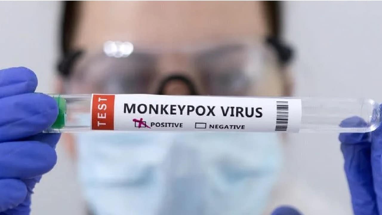 Texas registra la primera muerte con viruela del mono en EUA