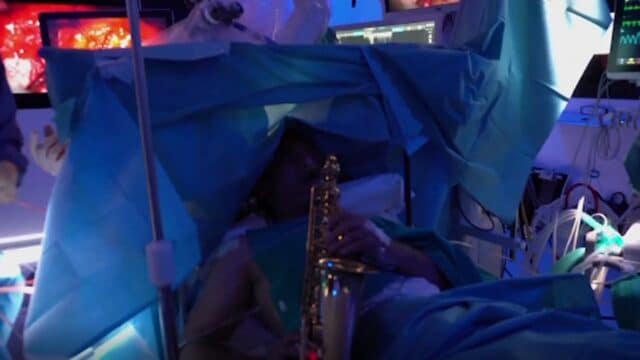 Video: Paciente de cirugía cerebral toca el saxofón mientras le extirpan un tumor.