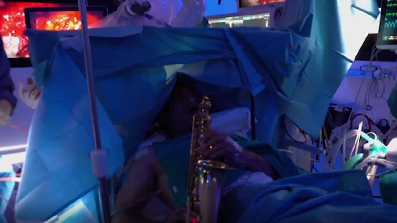Video: Paciente de cirugía cerebral toca el saxofón mientras le extirpan un tumor.